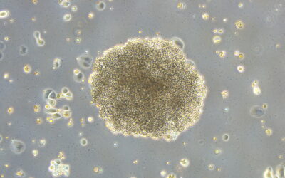 Científicos del CSIC describen un nuevo mecanismo molecular que modifica la eficacia de la quimioterapia